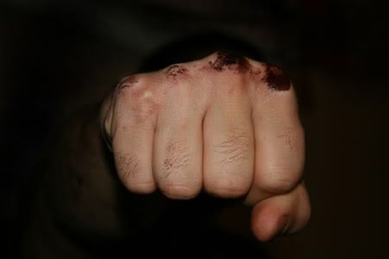 Image 1 of Fight
