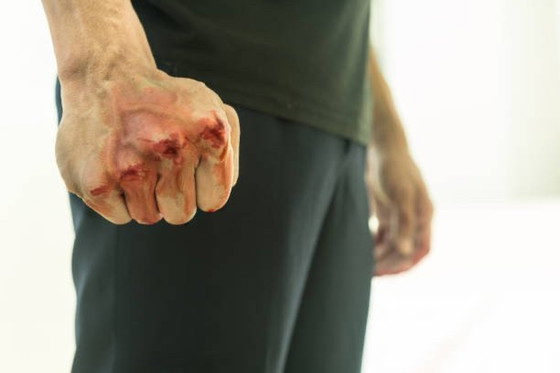 Image 1 of Combattre